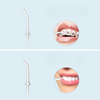 SmileEase™ - Irrigateur Oral Professionnel avec 5 Buses Multifonctionnelles