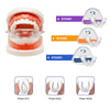 SmileEase™  -  Appareil orthodontique en 3 étapes