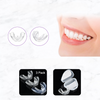 SmileEase™  -  Appareil orthodontique en 3 étapes