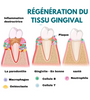 DentiZen™ Gel de thérapie gingivale